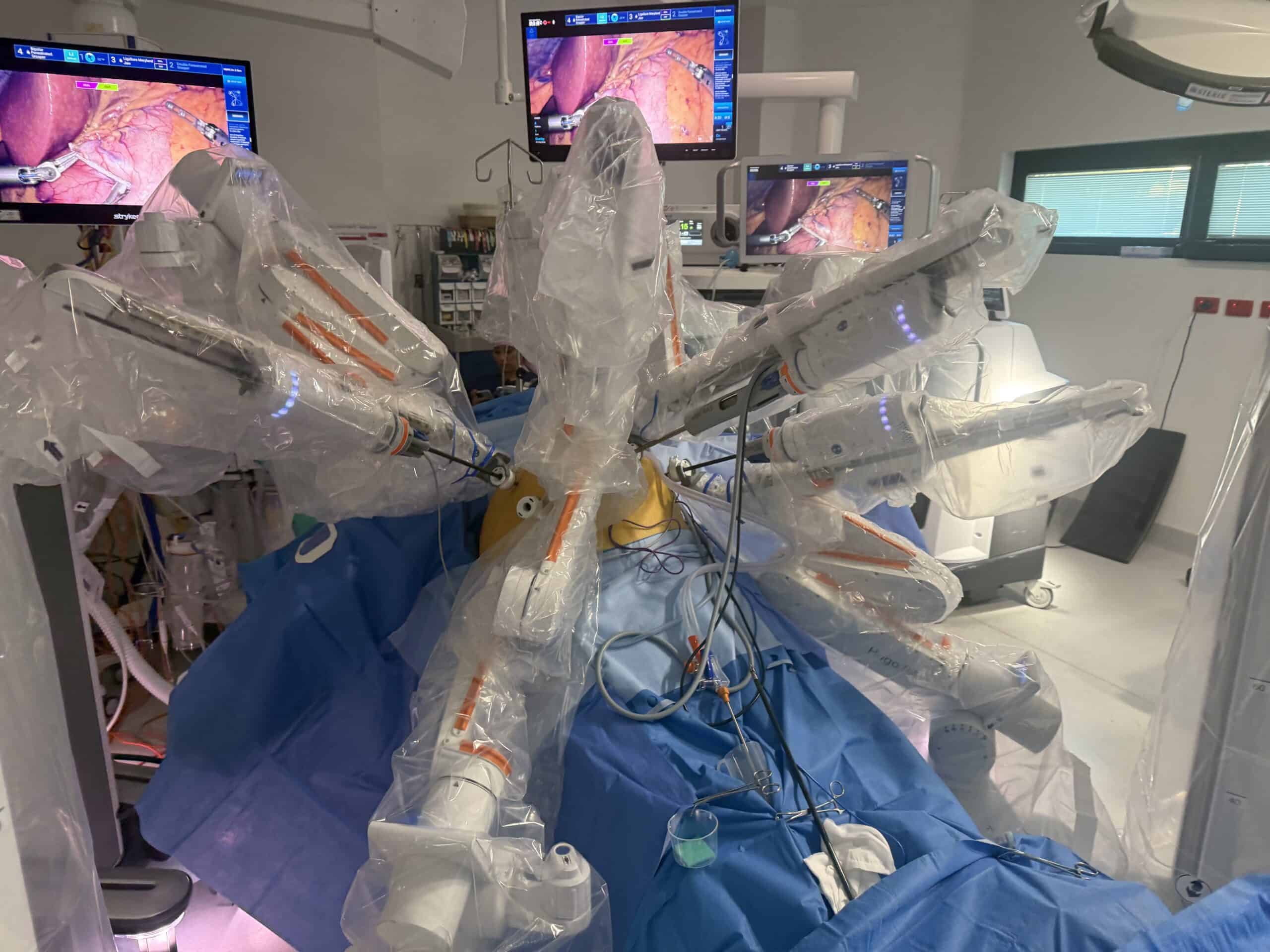 What is a robotic Cholecystectomy (gallbladder surgery)?